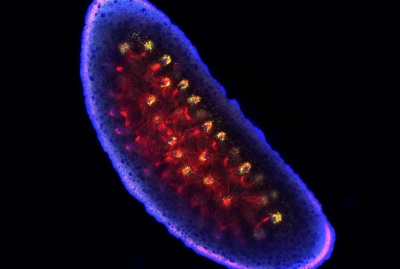 Color-enchanced Wolbachia bacteria