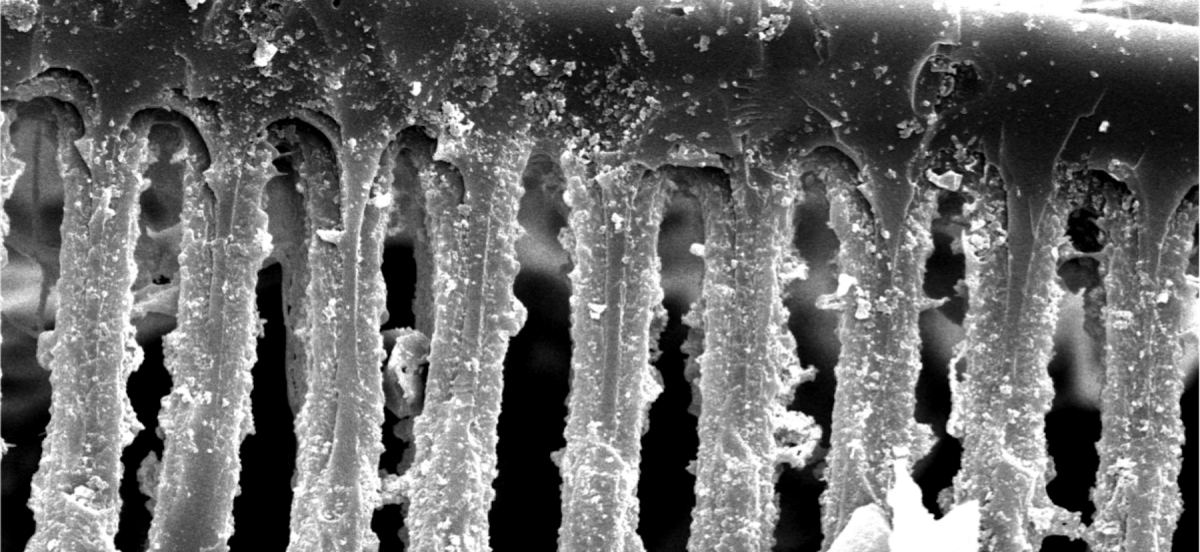 Detailed view of scalariform pitting on a stem xylem tracheid of Psaronius